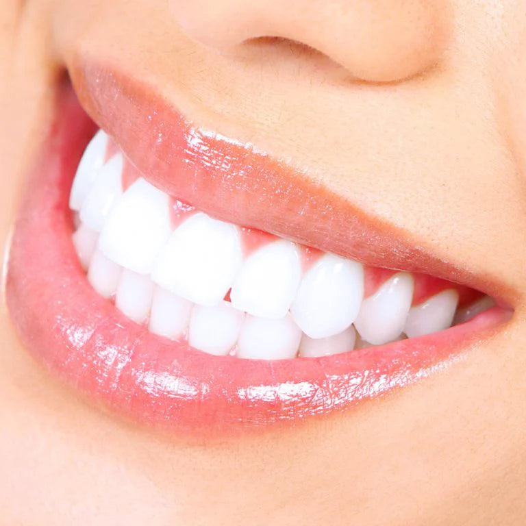 Teeth Whitener™ | Smile more!